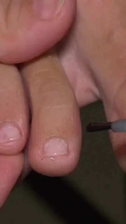 Nail polish on my feet and crumbs of feet between my toes