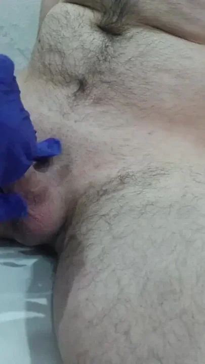 The nurse thoroughly massaged the patient's testicles and penis to collect sperm