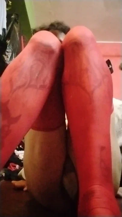 Bulge and feet