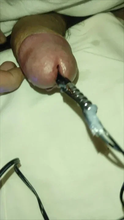 Electro cum Urerhra electro shock