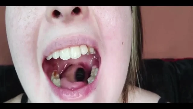 My Mouth Teeth Tongue and Throat up Close