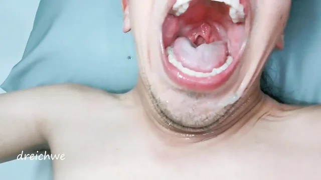 Saliva From My Mouth Drips All Over My Face