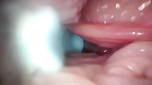 Semen in Cervix Wide Stretching Pussy Endoscope