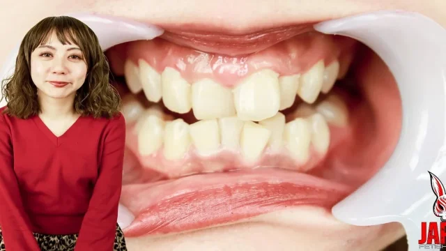 Inside Rumi's Mouth Explore Her Dental Care Secrets
