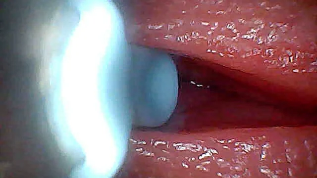 I couldnt believe what happens INSIDE the penis as sperm passes through endoscopic footage