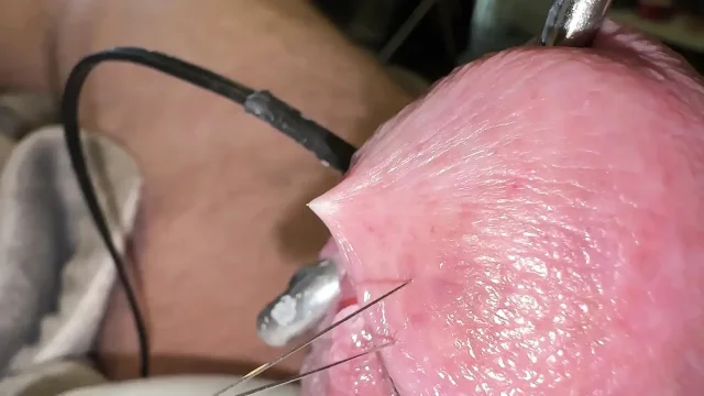 Ouch but it's very cool