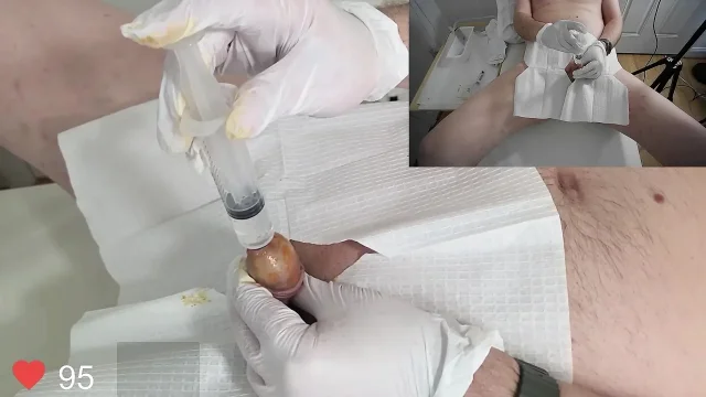 Reviewing my anatomy with you and inserting an 18 French Foley