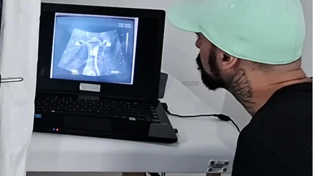 Gynecologist Performs Ultrasound Differently Next to the Cuckold