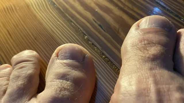 My feet exhausted after the workday