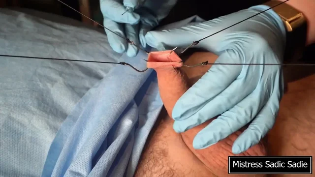 Needle CBT at It's Finest