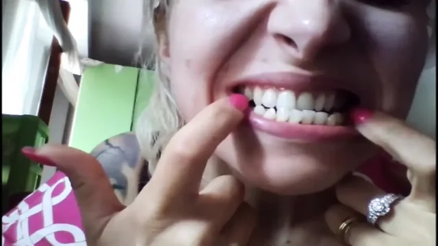 Beautiful Face but Rotten Teeth
