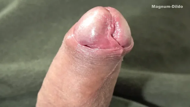My Foreskin Penis and Loose Asshole 2026 05